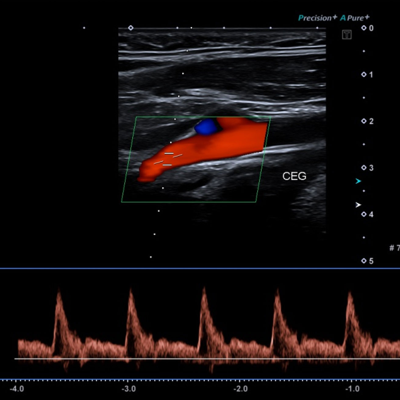 Doppler veineux et artériel images d'examen
